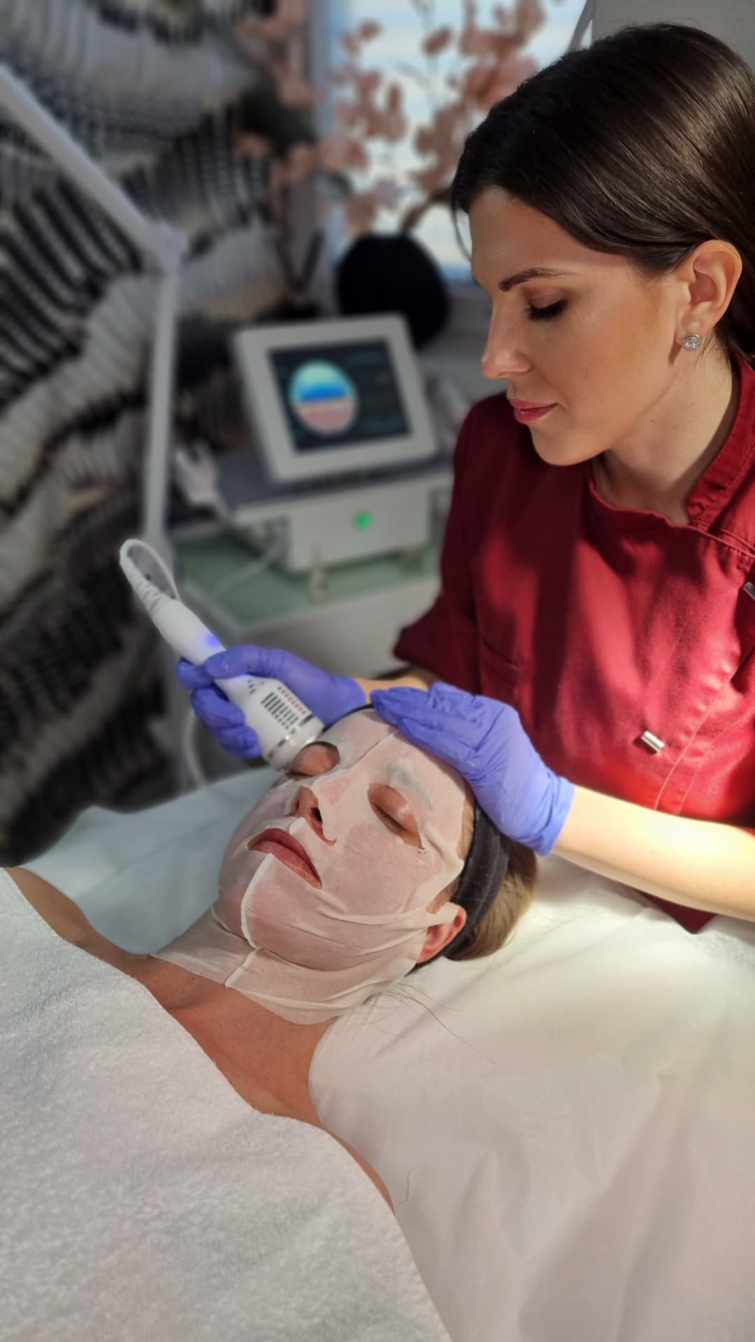 Radiofrekvenčni microneedling – fotografija 5, ESTETICAL Koper