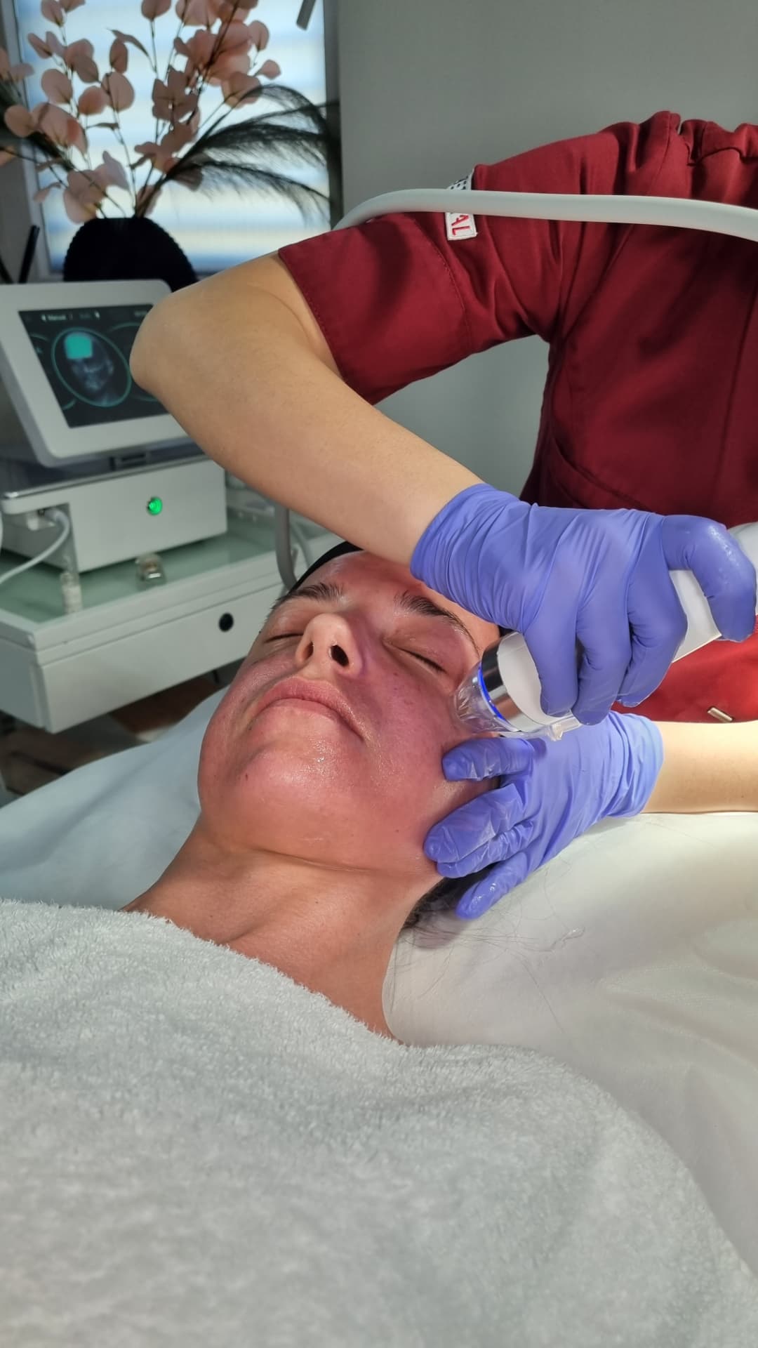 Mesoterapia, ESTETICAL Capodistria