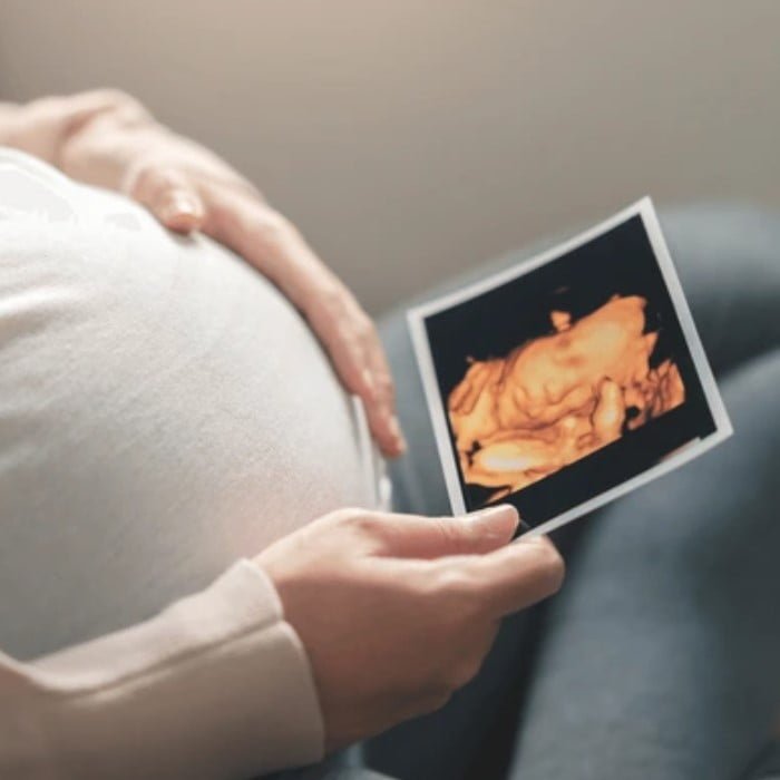3D/4D ultrazvočni pregled v nosečnosti
